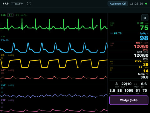 The NAP patient monitor on a haemodynamics teaching preset: the pulmonary artery trace under the ECG, pleth and capnography, with arterial 120/80, CVP 3, PAP 22/10, cardiac output 6.6 and SVR 1095 among the vital signs.