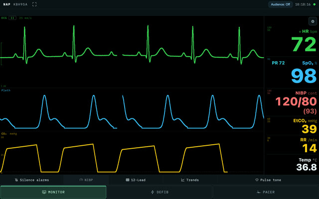 The NAP patient monitor showing ECG, pleth and capnography, with heart rate 72, SpO₂ 98 and blood pressure 120/80.